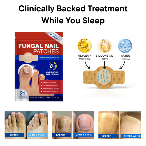 Mellio™ - Fungal Nail Repair Patches